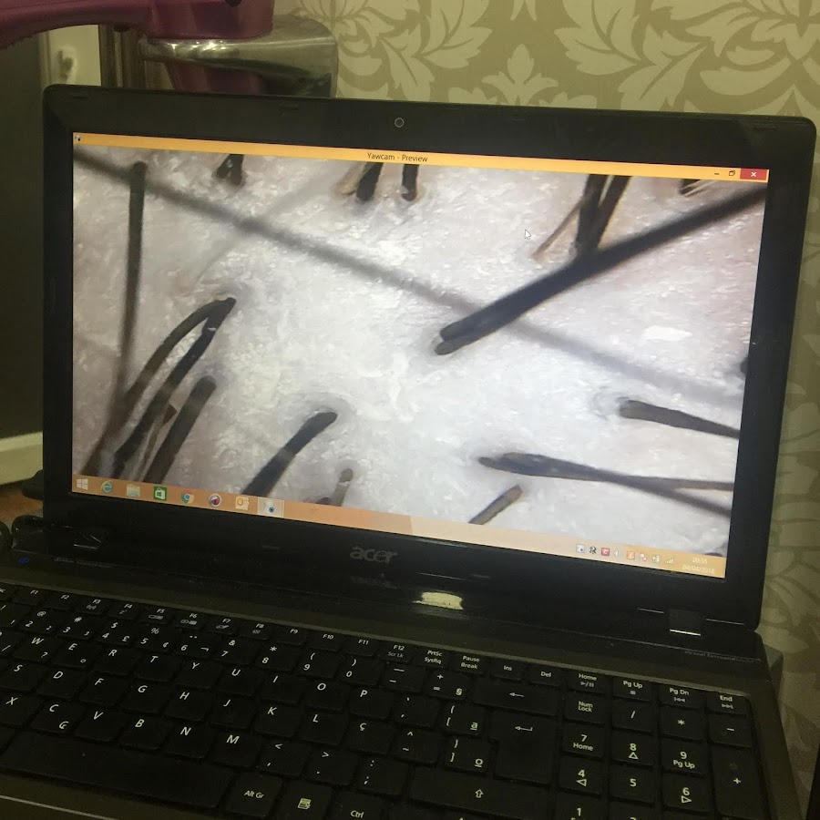 Oxigenación capilar, el tratamiento que le devolverá la salud y el brillo a tu pelo