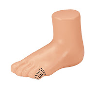 Little toe (kelingking kaki) Little toe (kelingking kaki)
