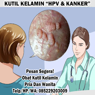 Obat Kutil Kelamin