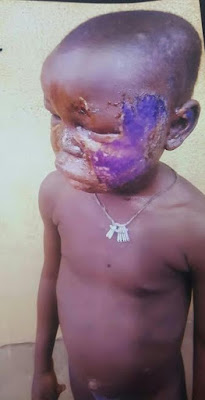 2 Man brutalizes his 5 year old daughter in Lagos (photos)