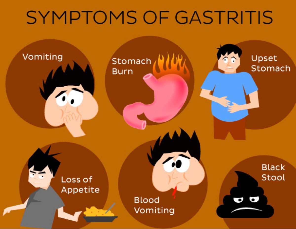 Причинами гастрита являются. Симптомы гастрита желудка. Гастрит причины возникновения. Основные симптомы гастрита.