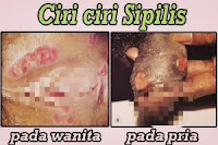 Obat Mengatasi Saat Kencing Terasa Perih Paling Manjur Obat Mengatasi Saat Kencing Terasa Perih Paling Manjur