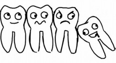 Răng khôn và cách điều trị nên chú ý