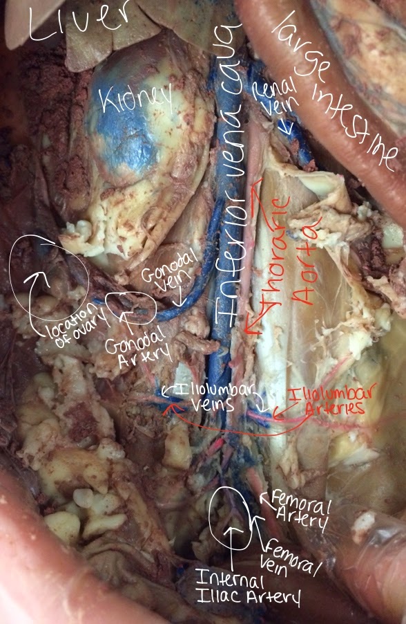 Semara's Mystifying Anatomy: The Veins and Arteries Below the Diaphragm