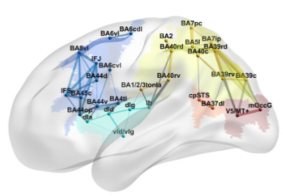 Brain誌：急性期発話機能の前頭 側頭-頭頂での乖離 | 脳卒中サバイバのゼンデラ Ⅱ