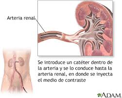 Función de la arteria renal
