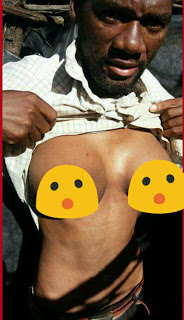 Image result for Man develops 'breast' after allegedly promising a lady marriage and failing to marry her (photos)
