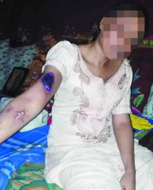Bride Kidnapped Days After Surviving Acid Attack By Rejected Suitor (pic)