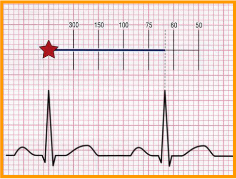 como medir frecuencia cardiaca en electrocardiograma