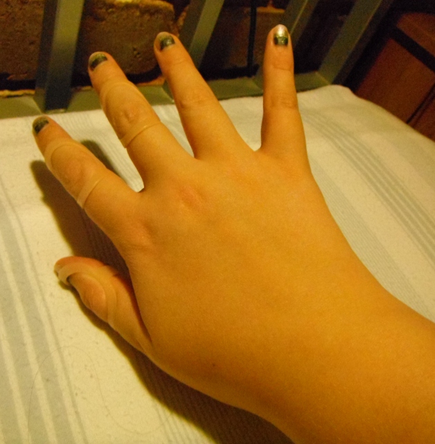 Amazin Arty Antics Random Swollen Hand Pics