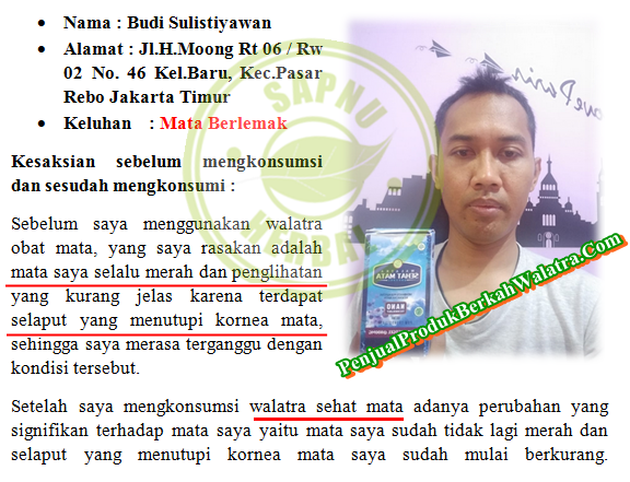 Cara Mengobati Mata Merah dan Pandangan Kabur yang Terbukti Mujarab ~ TESTIMONI SEHAT MATA SOFTGEL Cara Mengobati Mata Merah dan Pandangan Kabur yang Terbukti Mujarab ~ TESTIMONI SEHAT MATA SOFTGEL