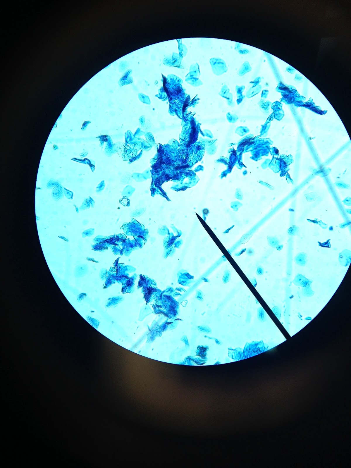 The Cinnamon Note Under The Microscope