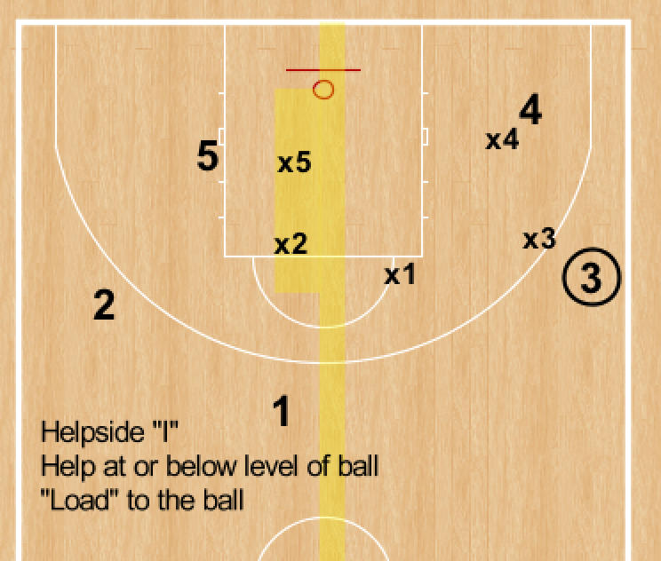 RonSenBasketball Basketball Defending the "Hard Stuff"