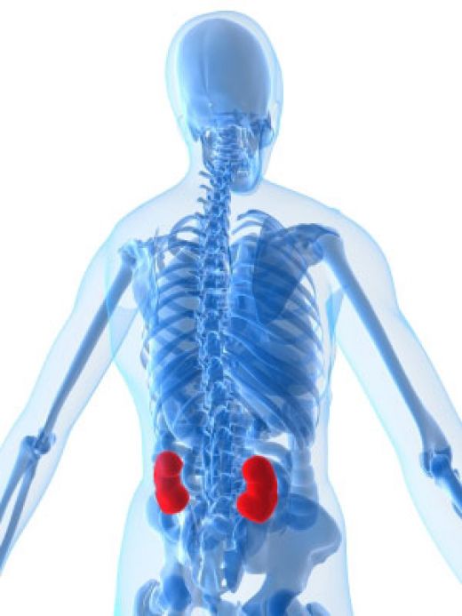 Back Pain That Refers To Kidney Stone
