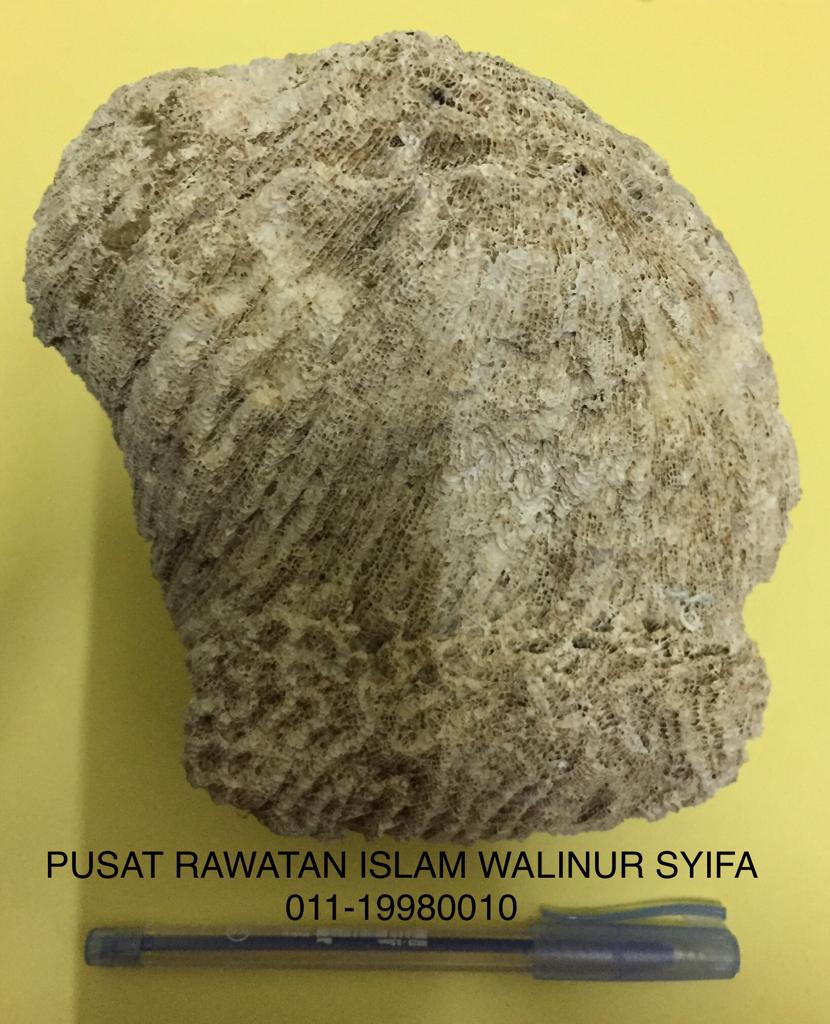 PUSAT RAWATAN ISLAM DAN TRADISIONAL WALINUR SYIFA / WALINUR SYIFA
