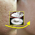 Natural Ingredients To Get Rid of Clogged Pores.