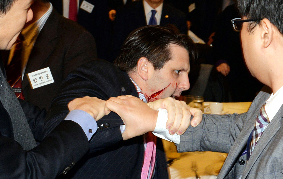El embajador estadounidense Mark Lippert tras ser atacado con un cuchillo en Seúl