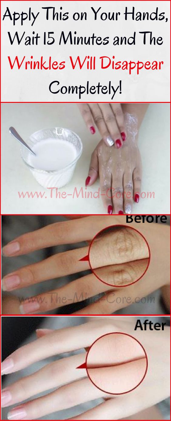 Apply this on your hands, wait 15 minutes and the wrinkles will