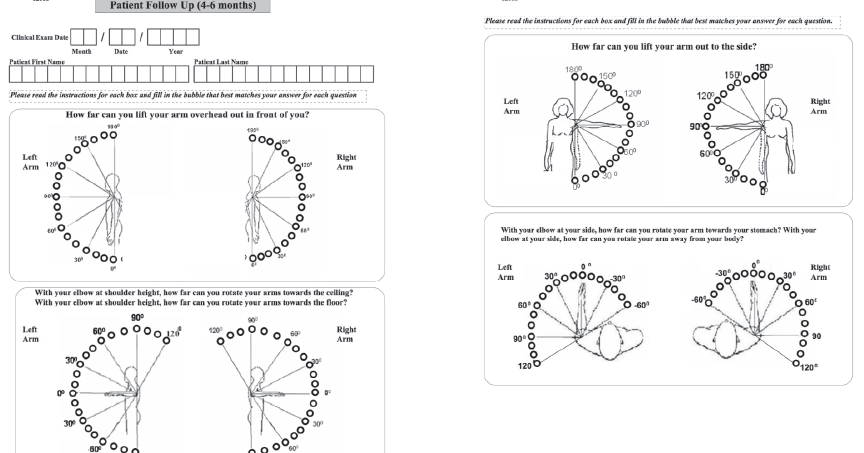 Shoulder Arthritis / Rotator Cuff Tears: causes of shoulder pain