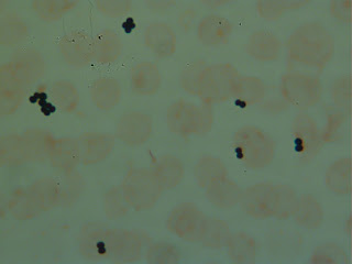 المكورات العنقودية المذهبة Staphylococcus aureus