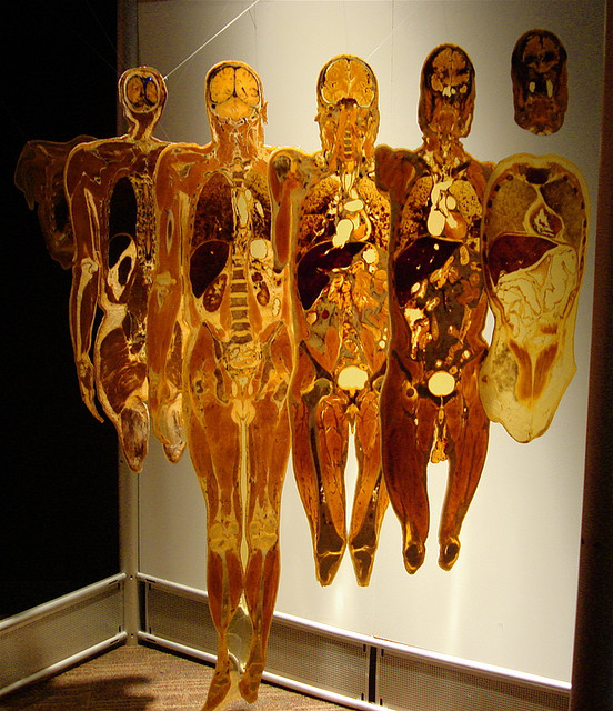 Albums 104+ Images people museum – the first museum of body worlds Completed