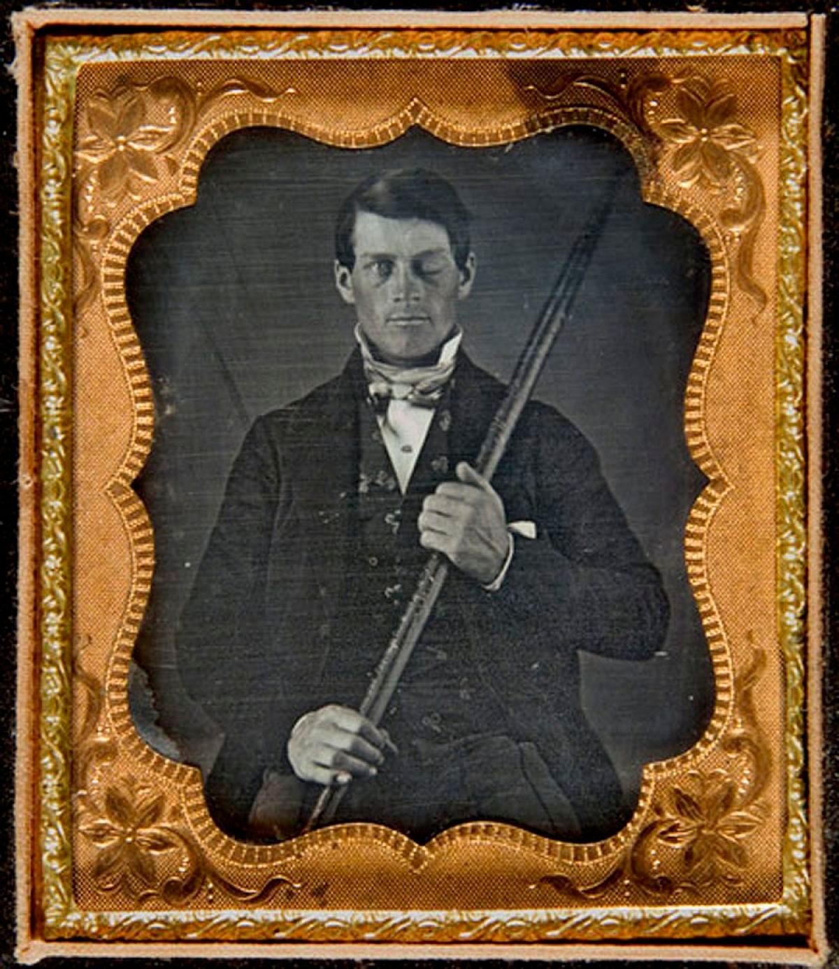 case study the case of phineas gage