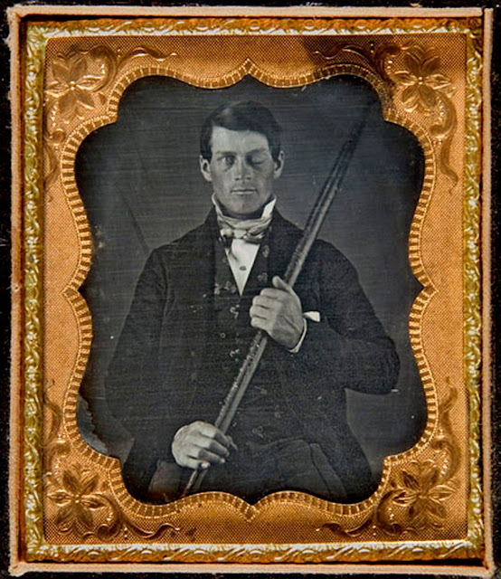 the case study involving phineas gage helped provide early evidence that