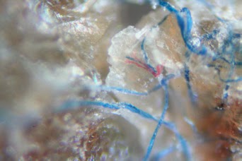 enfermedad de morgellons 2019 enfermedad de morgellons 2019