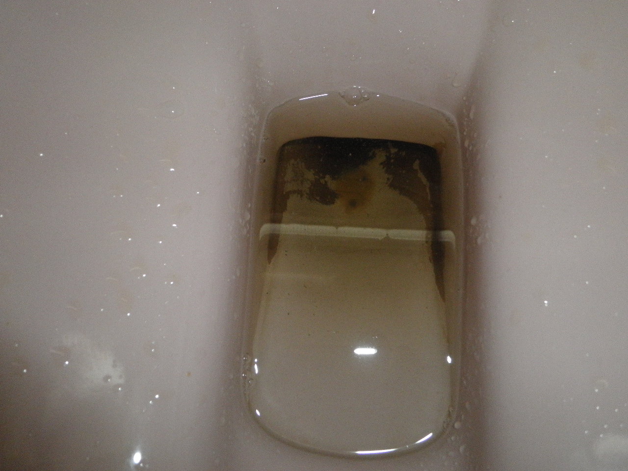 Gfscorner (金鱼堂) Haemorrhoids (piles)Rubber Band Ligation