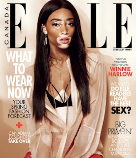 Winnie Harlow- Elle