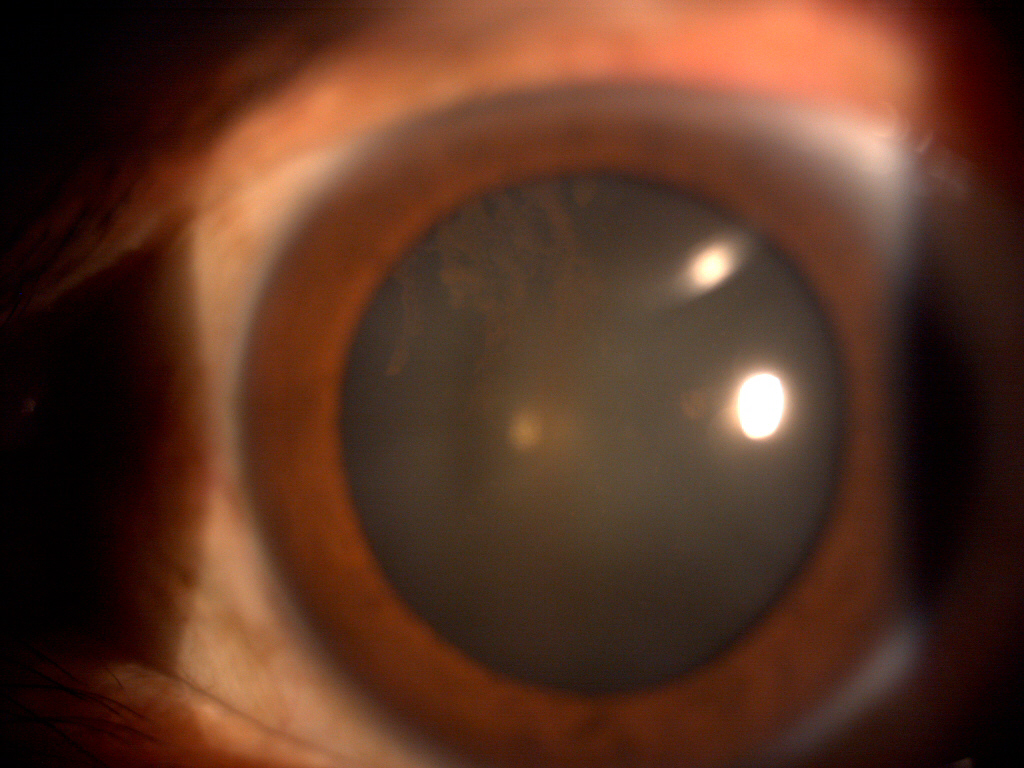 SPECIALIST BLOG "THE GLOG" PIGMENTARY