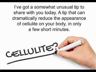 Cellulite Factor Overview, Cellulite, weight loss, fitness in gym, fitness gym,