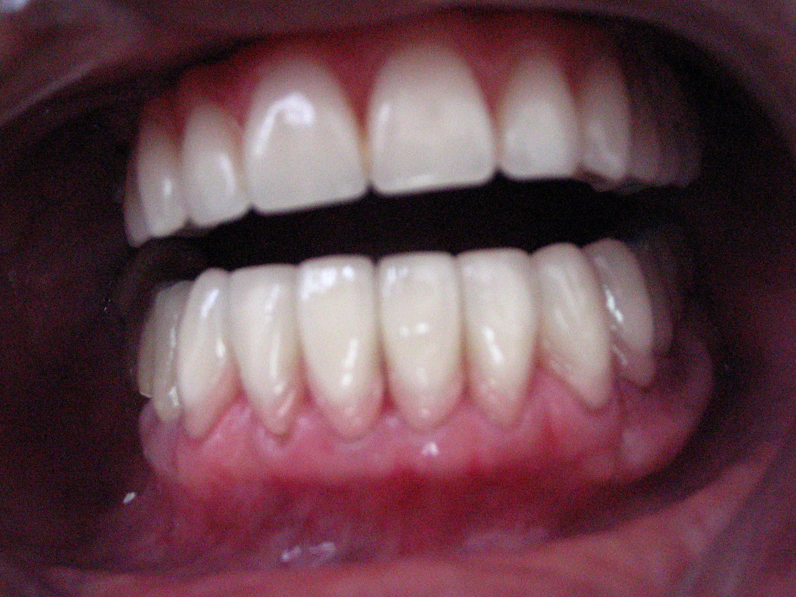 Dra. Ju Poppi: Sorrir ou falar? Por que não os dois?