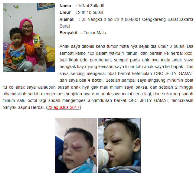 obat tumor herbal obat tumor