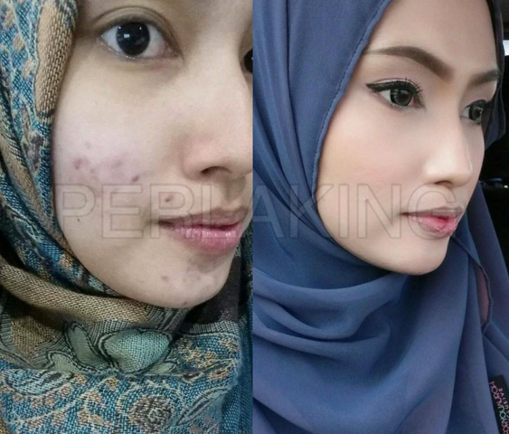 testimoni perla king serbuk mutiara