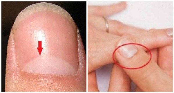 lunula-Half-Moon-Shape-On-Nails