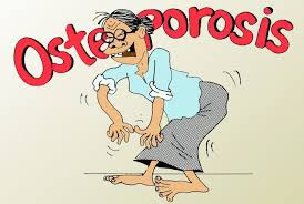 Obat Herbal Osteoporosis Yang Paling Ampuh Obat Herbal Osteoporosis Yang Paling Ampuh