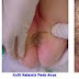 Jual Obat Kutil Kelamin Di Internet thumbnail