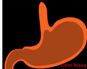Obat Maag Akut Kronis Tradisional Obat Maag Akut Kronis Tradisional