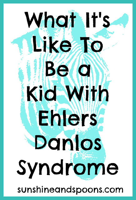 What it's like to be a kids with Ehlers Danlos Syndrome