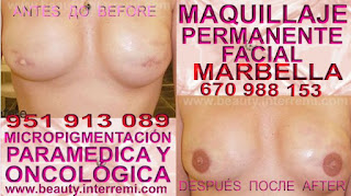 cicatrices reducción mamaria Tratamiento cicatrices pechos despues de una mastectomia