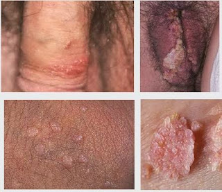 obat herbal untuk kutil kelamin obat kutil kelamin di apotik obat kutil kelamin di apotik century obat kutil kelamin di apotek kimia farma obat kutil kelamin di apotik k24 beli obat kutil kelamin di apotik merk obat kutil kelamin di apotik jual obat kutil kelamin di apotik obat generik kutil kelamin di apotik obat kutil kelamin apotik obat kutil kelamin yang dijual di apotik obat kutil kelamin yang tersedia di apotik harga obat kutil kelamin di apotek obat kutil kelamin di apotek harga obat kutil kelamin di apotik obat herbal kutil kelamin di apotik obat penghilang kutil kelamin di apotik salep obat kutil kelamin di apotik apa obat kutil kelamin di apotik obat kutil kelamin yang ada di apotik obat kutil kelamin yg ada di apotik obat kutil kelamin d apotik obat kutil kelamin yang bisa dibeli di apotik obat kutil kelamin yg dijual di apotik obat kutil kelamin dijual di apotek nama obat kutil kelamin yang dijual di apotik obat kutil kelamin yg di jual di apotik obat kutil kelamin di apotik kimia farma nama obat kutil kelamin di apotik obat kutil kelamin di apotik terdekat obat kutil kelamin di apotik umum obat kutil kelamin di apotik century obat kutil kelamin di apotek kimia farma obat kutil kelamin di apotik k24 beli obat kutil kelamin di apotik merk obat kutil kelamin di apotik jual obat kutil kelamin di apotik obat generik kutil kelamin di apotik obat kutil kelamin apotik obat kutil kelamin yang dijual di apotik obat kutil kelamin yang tersedia di apotik harga obat kutil kelamin di apotek obat kutil kelamin di apotek harga obat kutil kelamin di apotik obat herbal kutil kelamin di apotik obat penghilang kutil kelamin di apotik salep obat kutil kelamin di apotik apa obat kutil kelamin di apotik obat kutil kelamin yang ada di apotik obat kutil kelamin yg ada di apotik obat kutil kelamin d apotik obat kutil kelamin yang bisa dibeli di apotik obat kutil kelamin yg dijual di apotik obat kutil kelamin dijual di apotek nama obat kutil kelamin yang dijual di apotik obat kutil kelamin yg di jual di apotik obat kutil kelamin di apotik kimia farma nama obat kutil kelamin di apotik cara mengobati kutil kelamin cara mengobati kutil kelamin secara alami cara mengobati kutil kelamin pada wanita cara mengobati kutil kelamin dengan bawang putih cara mengobati kutil kelamin pada pria cara mengobati kutil kelamin pd wanita cara mengobati kutil kelamin dengan propolis cara mengobati kutil kelamin dengan cuka cara mengobati kutil kelamin dengan cuka apel cara mengobati kutil kelamin dengan lidah buaya cara mengobati kutil kelamin secara herbal cara mengobati kutil kelamin tanpa operasi cara mengobati kutil kelamin dengan alami cara mengobati kutil kelamin wanita cara mengobati kutil kelamin secara medis cara mengobati kutil kelamin dengan albothyl cara mengobati kutil kelamin sendiri cara mengobati kutil kelamin dengan kapur sirih cara mengobati kutil kelamin dengan herbal cara menghilangkan kutil kelamin wanita cara menghilangkan kutil kelamin pria cara mengobati kutil kelamin alami cara mengobati kutil pada alat kelamin pria cara pengobatan kutil kelamin secara alami cara menghilangkan kutil kelamin pria secara alami cara menghilangkan kutil di alat kelamin secara alami cara mengatasi kutil kelamin secara alami cara penyembuhan kutil kelamin secara alami cara menghilangkan kutil kelamin dengan alami cara mengobati kutil pada alat kelamin cara menghilangkan kutil kelamin secara alami dan cepat cara mengobati kutil kelamin dengan bahan alami cara menghilangkan kutil kelamin dengan bahan alami cara menghilangkan kutil pada alat kelamin cara menghilangkan kutil di alat kelamin pria cara menghilangkan kutil kelamin dengan bawang bagaimana cara mengobati penyakit kutil kelamin cara mengobati kutil kelamin dengan bawang cara menyembuhkan kutil kelamin dengan bawang putih cara pengobatan kutil kelamin dengan bawang putih cara menghilangkan kutil kelamin dengan bahan tradisional bagaimana cara mengobati kutil kelamin cara menghilangkan kutil di bagian kelamin cara menghilangkan kutil kelamin dengan cepat cara cepat mengatasi kutil kelamin cara mengobati kutil kelamin dengan cuka sari apel cara menghilangkan kutil kelamin dengan cuka apel cara pengobatan kutil kelamin dengan cuka apel cara cepat mengobati kutil kelamin cara mengobati kutil kelamin dengan cara alami cara mengobati kutil kelamin dengan tradisional cara mengobati kutil kelamin dengan tumbuhan cara mengatasi kutil di kelamin cara menghilangkan kutil di kelamin pria cara pengobatan kutil di kelamin cara mengobati kutil kelamin herbal cara menghilangkan kutil kelamin pada ibu hamil cara menyembuhkan kutil kelamin secara herbal cara mengobati kutil kelamin pada ibu hamil cara menghilangkan kutil kelamin dengan kapur sirih cara menghilangkan kutil di kelamin laki laki cara menghilangkan kutil kelamin secara medis cara mudah mengobati kutil kelamin cara mencegah dan mengobati kutil kelamin cara mengobati kutil kelamin dengan obat tradisional cara mengobati kutil kelamin pada anus cara mengatasi kutil kelamin pria cara menyembuhkan kutil pada kelamin cara penyembuhan kutil pada kelamin cara mengatasi kutil pada kelamin pria cara menyembuhkan kutil kelamin pada wanita cara menyembuhkan kutil kelamin pada pria cara mengobati penyakit kutil pada kelamin cara mengobati penyakit kutil kelamin cara mengobati penyakit kutil kelamin secara alami cara mengatasi penyakit kutil kelamin cara mengobati kutil pada kelamin cara menghilangkan kutil di sekitar kelamin cara menghilangkan kutil kelamin secara tradisional cara menyembuhkan kutil kelamin secara tradisional cara menghilangkan kutil di kelamin secara alami cara menghilangkan kutil pada kelamin secara alami cara mengobati kutil kelamin tradisional cara tradisional mengobati penyakit kutil kelamin cara obat kutil kelamin tradisional cara menghilangkan kutil kelamin tradisional cara menghilangkan kutil kelamin tanpa obat cara menghilangkan kutil di kelamin wanita cara mengatasi kutil kelamin wanita cara mengobati kutil di kelamin wanita cara menghilangkan kutil kelamin pada wanita cara pengobatan kutil kelamin pada wanita cara mengobati penyakit kutil kelamin pada wanita