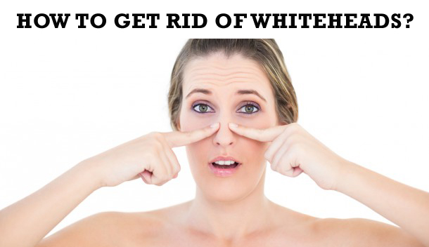 How to get rid of Whiteheads in 5 minutes?