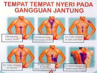 Tempat keluhan sakit jantung koroner Tempat keluhan sakit jantung koroner