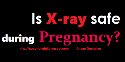 Is X-ray safe during Pregnancy?