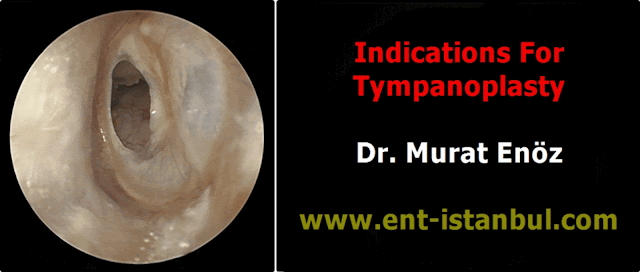 Tympanoplasty Indications