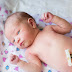 5 Gangguan Kesehatan yang Sering Terjadi Pada Bayi yang Baru Lahir