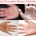 Resep obat eksim basah di apotik thumbnail