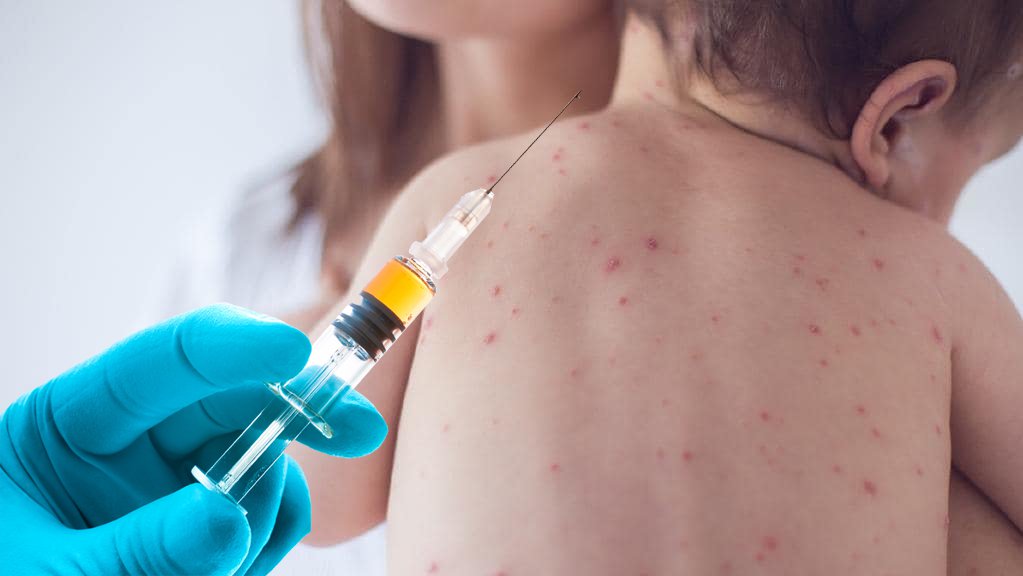 O depoimento bombástico do médico diante do Congresso revela como as vacinas MMR aumentam as mortes por sarampo O Dr. Brian Hooker prestou depoimento na última sexta-feira, 8 de fevereiro de 2019, para o Comitê de Saúde da Câmara de Washington sobre as vacinas e a lei de Isenção de Crenças Pessoais (PBE) que foi introduzida.