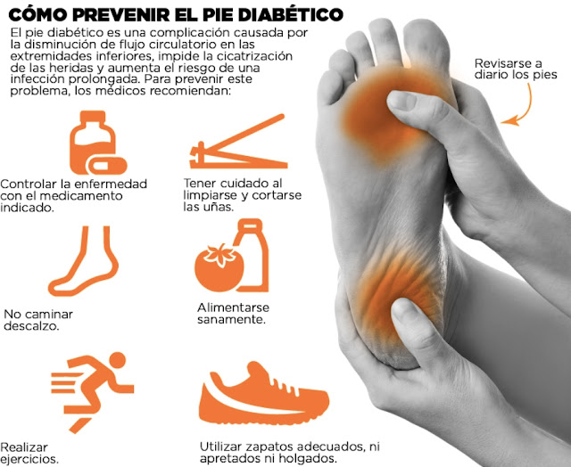 Guía sanitaria Pié diabético